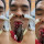 Artis Saipul Jamil Terapi Lintah di lidah dan Hidung Ini Mengerikan